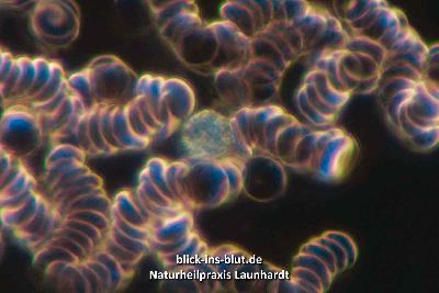 Geldrollenbildung der Erythrozyten